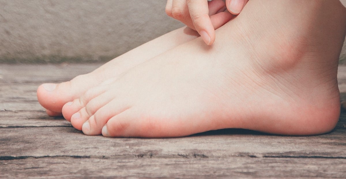 How to get rid of blisters - main image