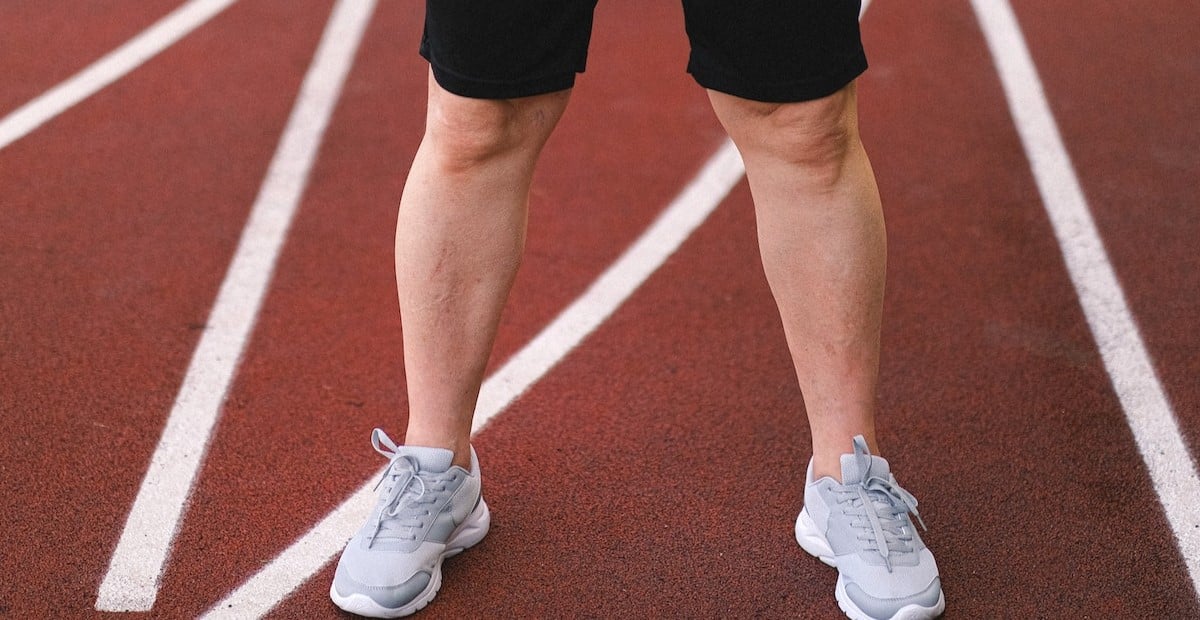 How to drain lactic acid from legs
 - main image